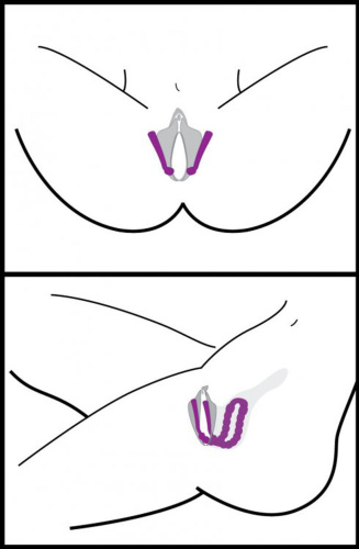 Oral Enhancing Hands Free Labia Spreader  3